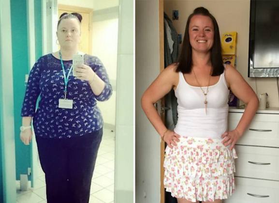 160 Pound Weight Loss Through Pictures Of Spider